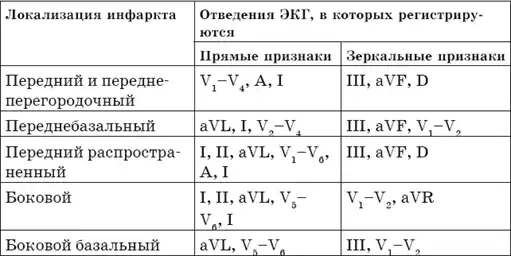 Что показывает кардиограмма.