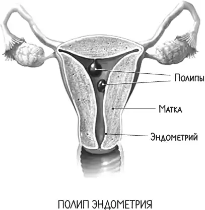Project woman. �������� ��������� �������� ���������: �����, ��� �������� ���� ����.